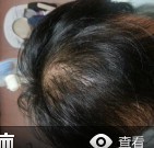 赶快戒掉手淫不然这个就是下场