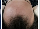 赶快戒掉手淫不然这个就是下场