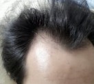 赶快戒掉手淫不然这个就是下场