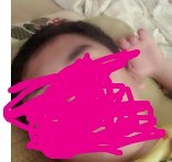 赶快戒掉手淫不然这个就是下场