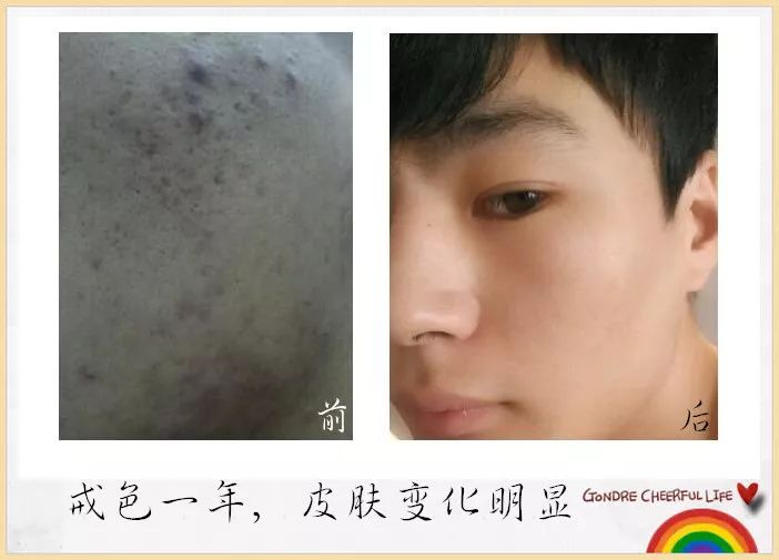 戒色一年,皮肤变化明显